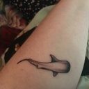 unwanted tattoo on arm