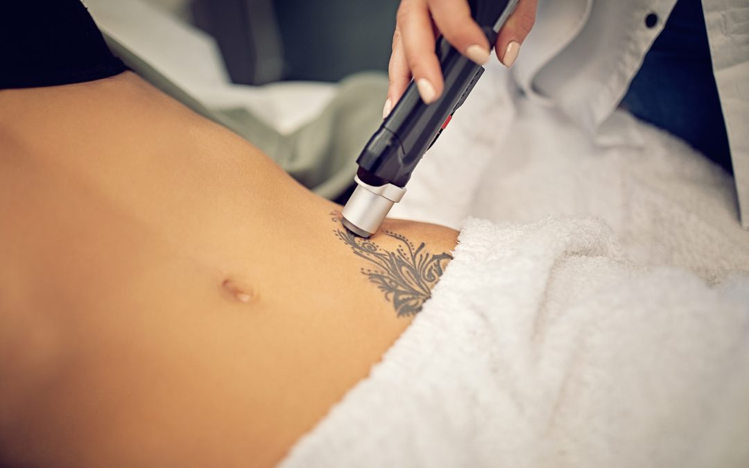 Answering Frequently Asked Questions: Exploring The Ins & Outs Of Tattoo Removal